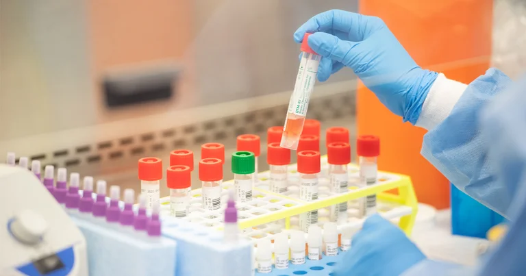 These 16 countries cannot enter Kosovo without PCR test