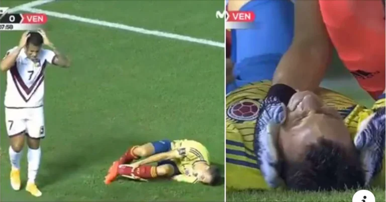 Heavy view: The opponent started crying when he saw the Colombian player's injury last night.
