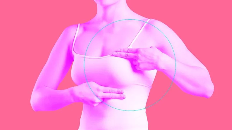 Facteurs du cancer qui augmentent le risque de cancer du sein