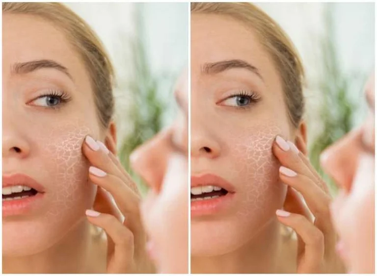 Dermatologists advise: 5 products to use from October to February