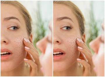 Dermatologists advise: 5 products to use from October to February