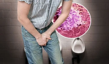 Ist das genau nach dem Urinieren passiert? Es kann Prostatakrebs signalisieren