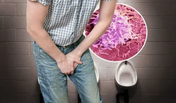 Ist das genau nach dem Urinieren passiert? Es kann Prostatakrebs signalisieren