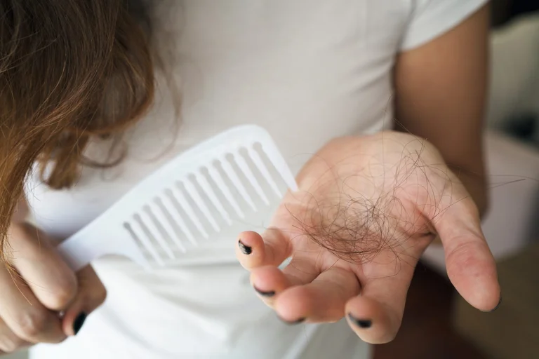 Hai un sacco di capelli? Scopri perché succede in questi mesi