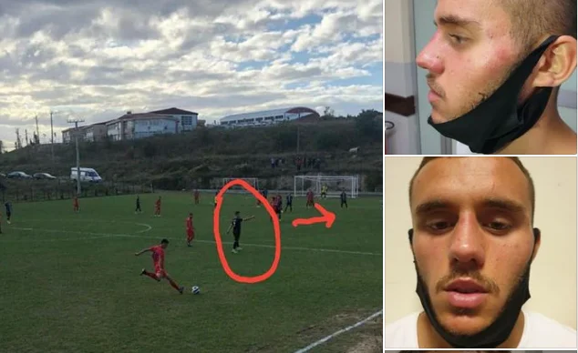 Beats in Kosovo calcio, calciatori, allenatore andare in ospedale