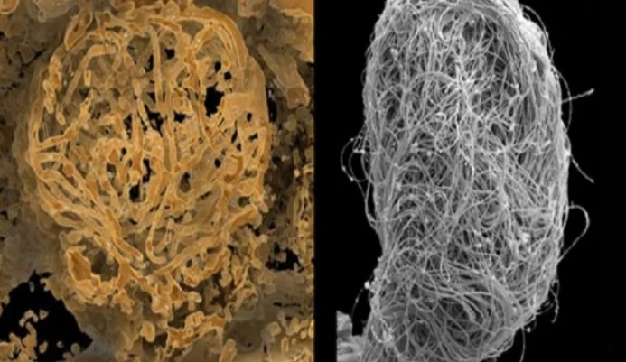 World's oldest sperm sample detected in amber
