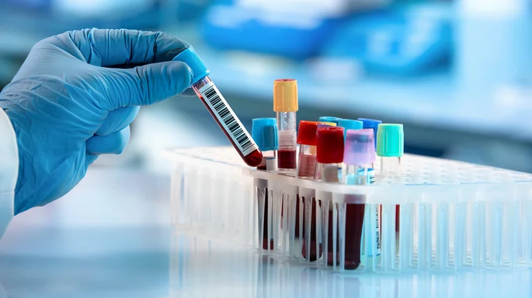 A po i fsheh IKSHPK-ja rezultatet e testeve PCR Covid-19 të laboratorëve privatë?