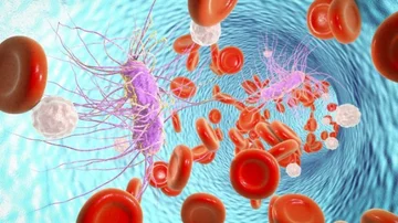 This disease kills eleven million people a year, and three million children: Keep the first symptoms in mind