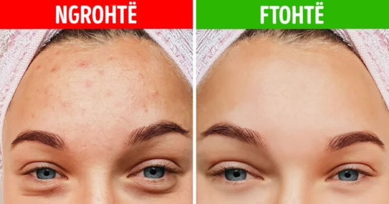 5 A Miracle That a Cold shower Makes for Your Skin
