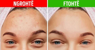 5 A Miracle That a Cold shower Makes for Your Skin