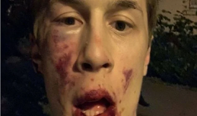 Putin's opponent brutally beaten