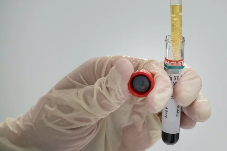 I test serologici possono essere condotti entro la prossima settimana in Gjakova
