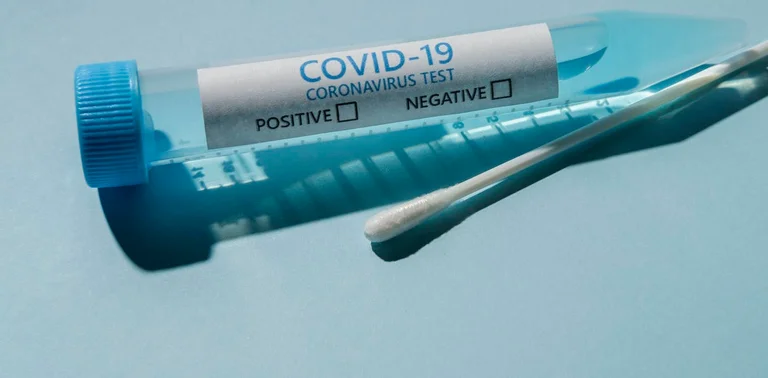 AKK no encuentra violaciones de los precios de los test Coronavirus, sin quejas de ciudadanos