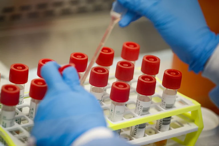 Licensohet 11 laboratorë të tjerë për të kryer testime serologjike në Kosovë