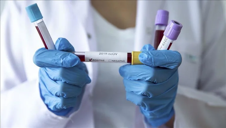 Nga këto komuna janë të prekurit e fundit me koronavirus