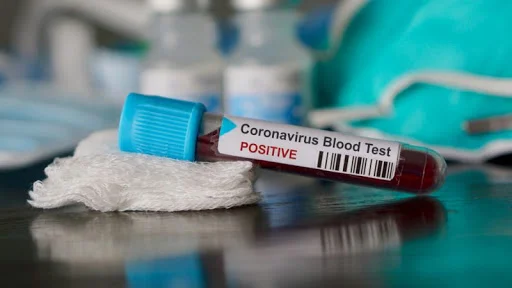 Qytetarët të pakënaqur me punën e laboratoreve private rreth testimeve për COVID-19