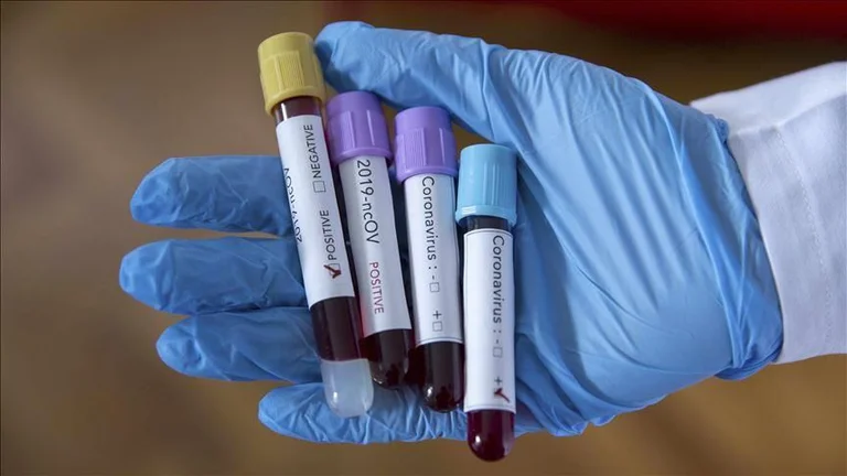 Prej 82 rasteve të reja me koronavirus, 41 vetëm në Prishtinë