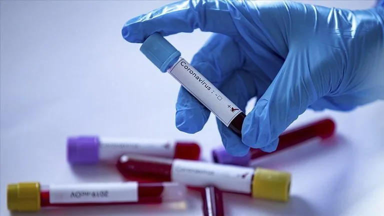 Casos positivos de cronavirus son reportados por estos municipios