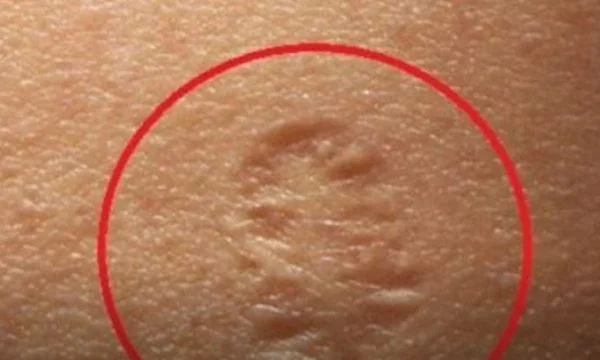 Abbiamo tutti questa piccola cicatrice sul nostro braccio: E' questo che significa.