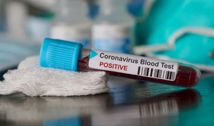 Nuevos casos Coronavirus reportados por estos municipios