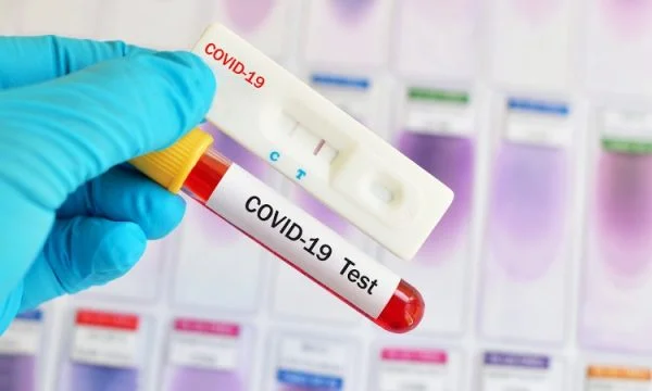 100 klinika private duan të kryejnë teste për Covid 19, a do t’i lejojë Ministria e Shëndetësisë