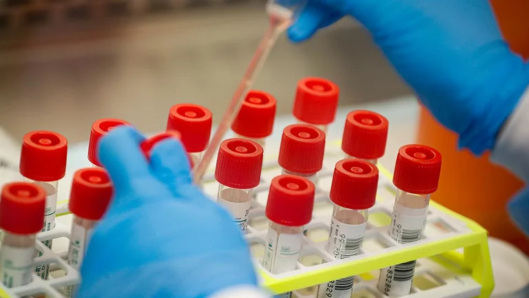 L'Union européenne réserve 400 millions de doses de vaccins possibles - CO VID19
