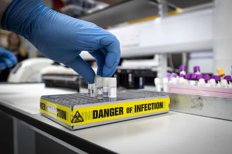 Auch lizenziert sind 10 private Labors zur Durchführung serologischer Tests
