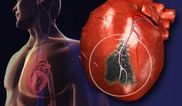 Perché sono sempre più malati di cuore che muoiono?