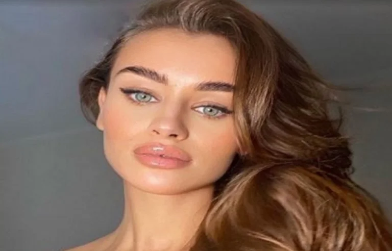Rojet turke rrahin modelen ukrainase (Foto)