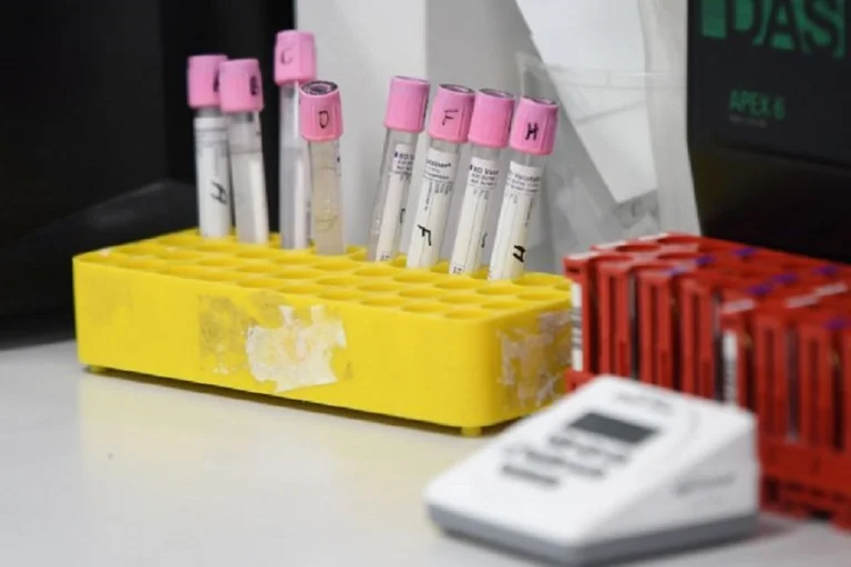 Numri i viktimave dhe të prekurve me koronavirus në të gjithë botën