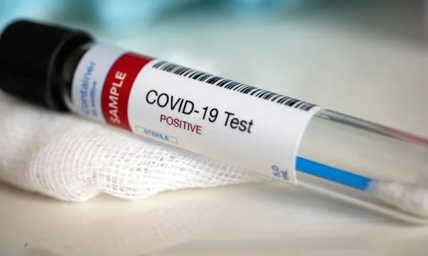 KMDLNj: Përzgjedhja diskriminuese e testimeve po shkakton rritjen e numrit të prekurve me COVID-19