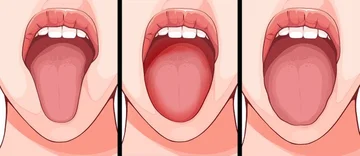 6 Things Your Language Can Reveal About Health