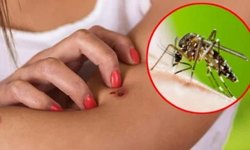 Quattro modi naturali per mantenere le zanzare dal vostro corpo