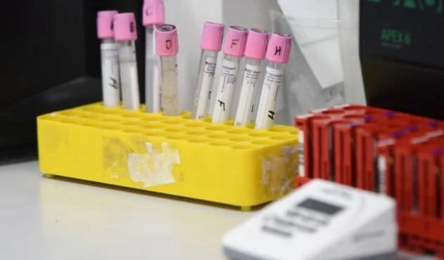 Numero di persone infette aumentate con COVID-19 in Croazia