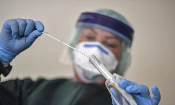 Who waits to be tested for coronary in Kosovo