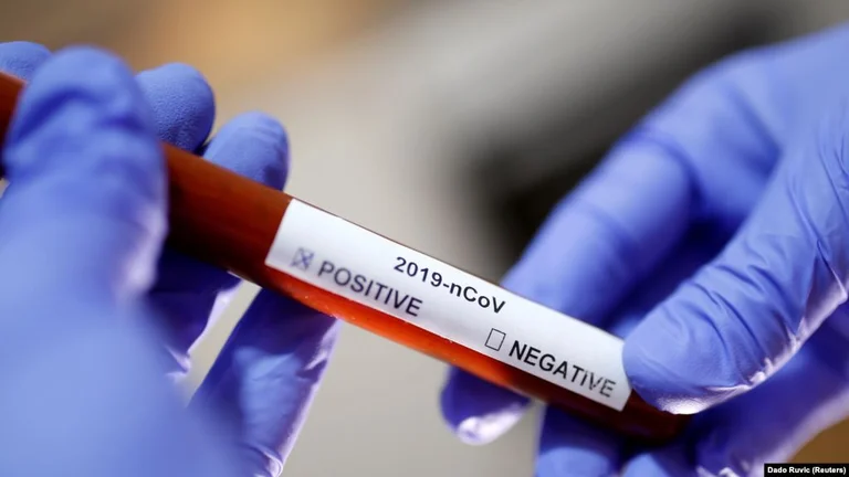Rritje e numrit të të prekurve me koronavirus në Maqedoninë e Veriut