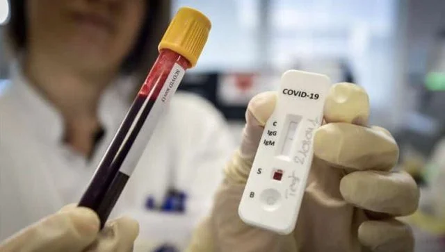 Di 600 test Serologici a Pristina, il 13 per cento positivo per la coronaria