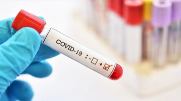 Pandemia godet bizneset, rreth 800 milionë euro më pak qarkullim financiar