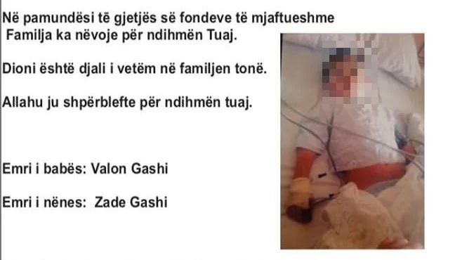 5 vjeçari nga Gjilani ka nevojë për trajtim jashtë vendit