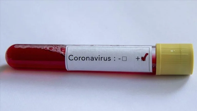 Malisevo today, a man healed with COVID-19 and two people resulted in negative COVID-19