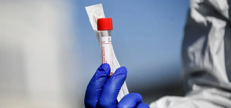 Il prezzo degli ospedali privati sarà determinato per i test coronarici, parlano dal MSH