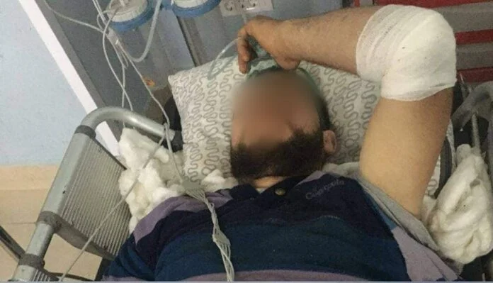 Solicitando ayuda para el joven Podujevo, que fue gravemente herido por el rodillo del tractor en Breca