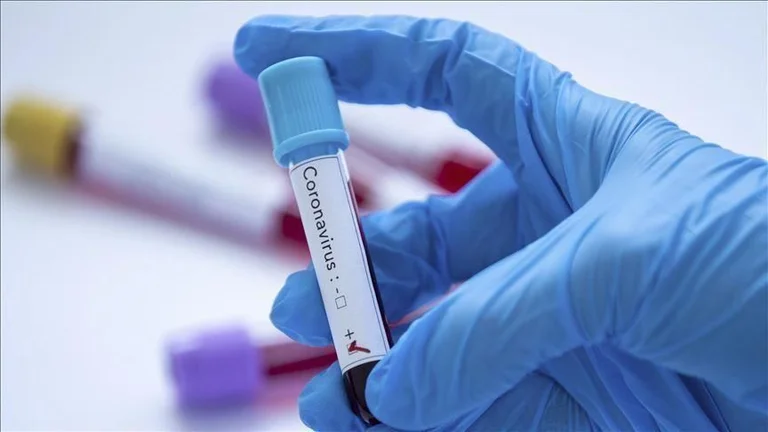 75 raste të reja me koronavirus në Kosovë, 38 të shëruar