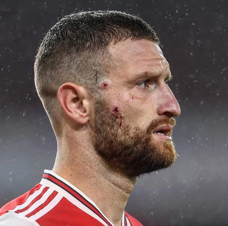Mustaf Shkodra with a very sincere post after being brutally kicked in the face by Jamie Vardy