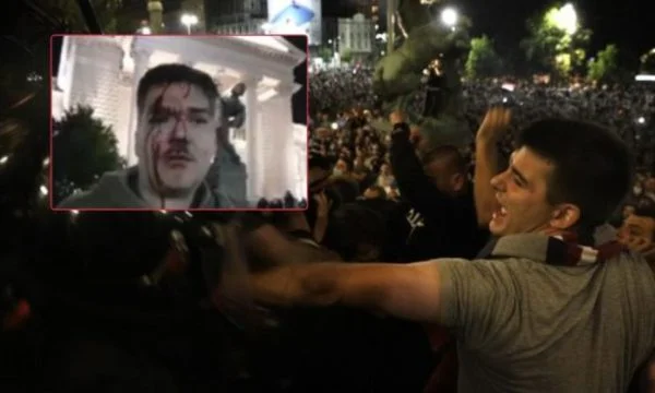 “Arreston Vucicin” photos of violence and bloody protesters in Belgrade invade the media