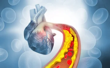 Signs showing that your arteries are blocked and you have to go to the doctor immediately