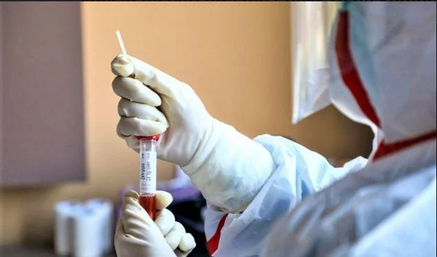 Due persone muoiono con Coddy-19 in Albania