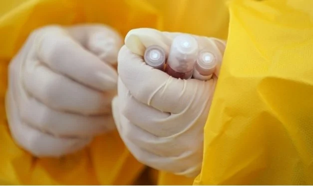 L'economia dell'Australia avrà bisogno di altri 90 miliardi dopo il compagno di Coronavirus