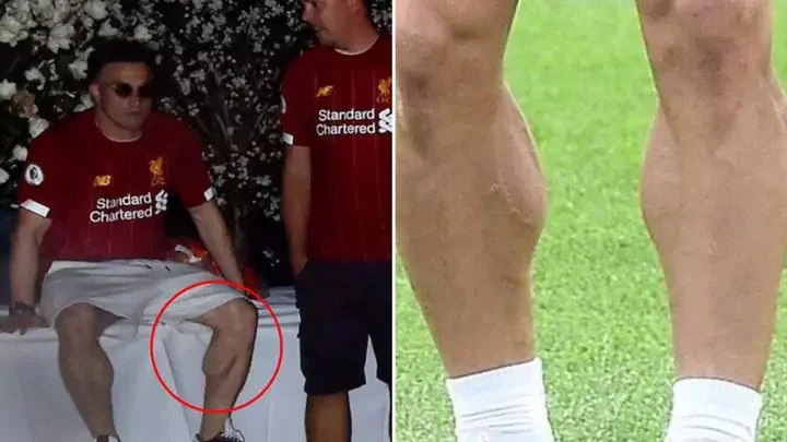 Gerdan Shaqiri und seine mad Physik gehen viral.
