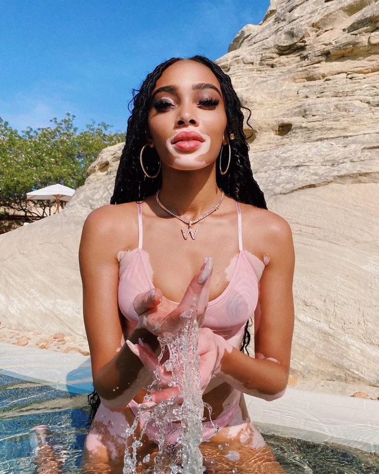 No has visto a Winnie Harlow tan caliente.
